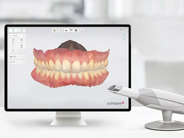 3D mondscanner